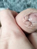 Foreskin after a fuck