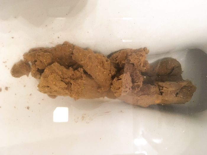 Toilet Poops (up to April 2020)