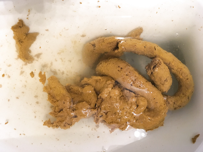 Toilet Poops (up to April 2020)