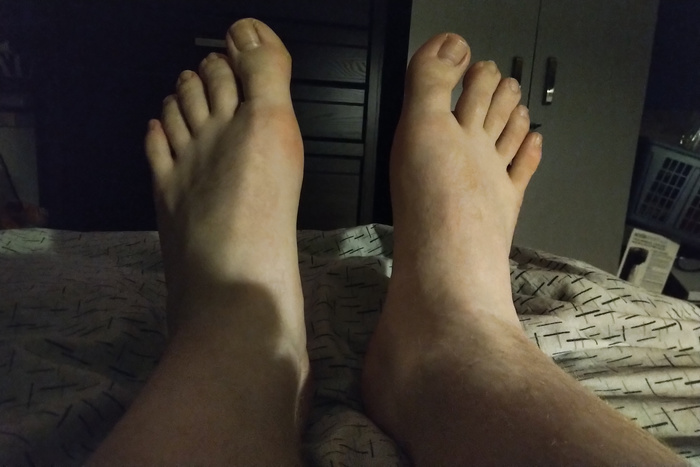 My feet - album 147