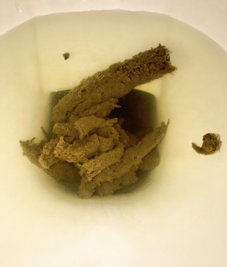 Shitting on the toilet