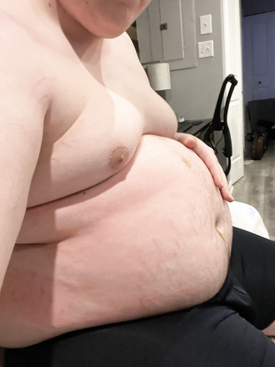N2o belly inflation / before & after pics