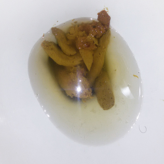 Toilet scat