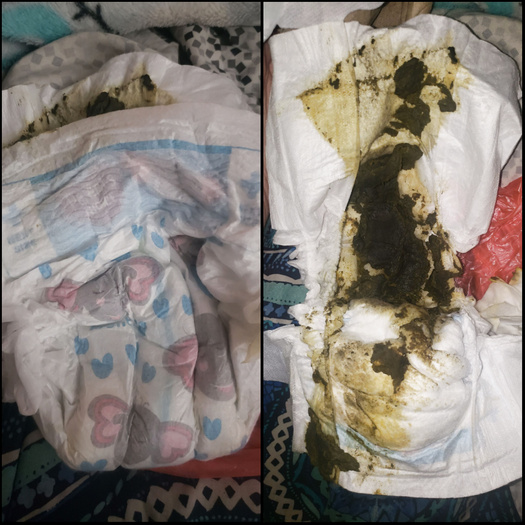 What a messy surprise I found. Messy parent's choice diaper.