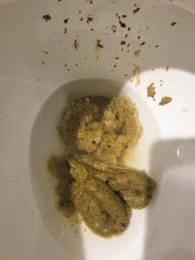 My Best Poops!