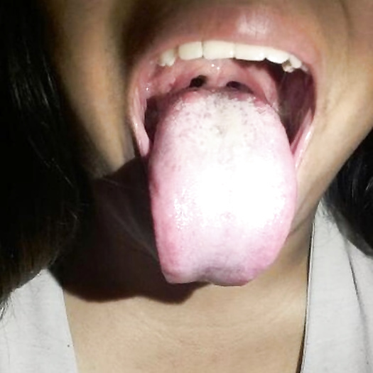 Tongues white