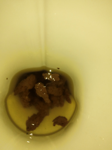 Big poops