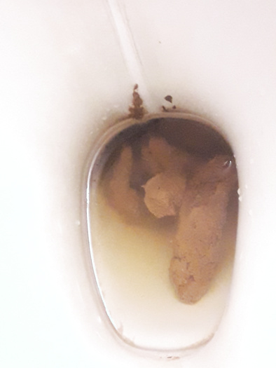 Poop number 1. Good and hard  tight poop. Feeling so good when i push it out slowly.