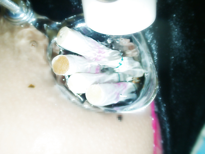 Anal ashtray