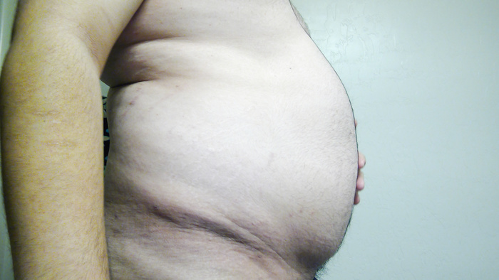 Belly inflation - album 6