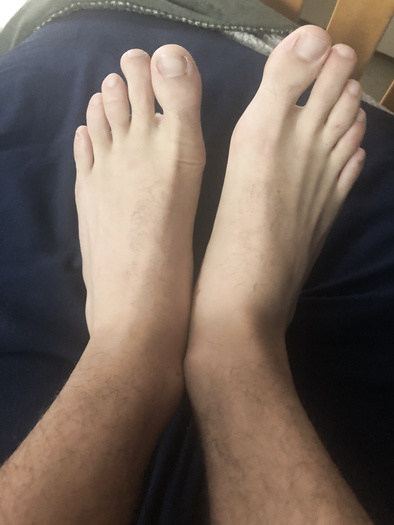Hypno Feet