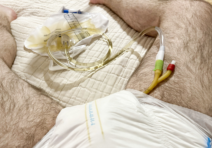 Catheterized and Diapered