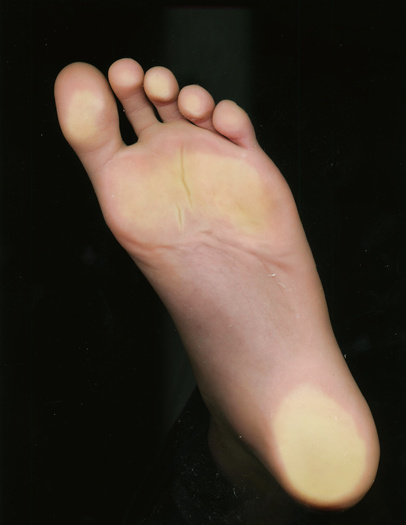 Footprint Damian feet