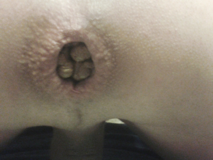 My hole and my shit