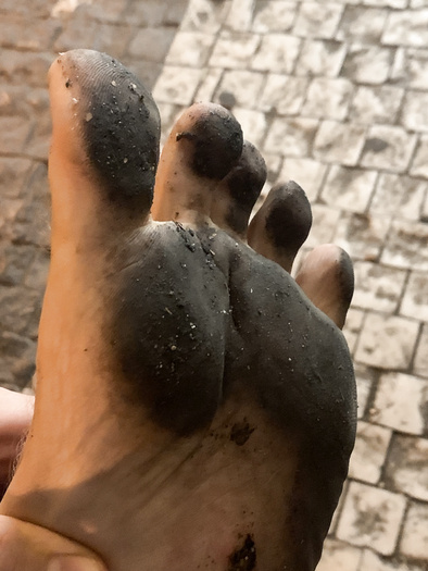 My dirty feet - album 5