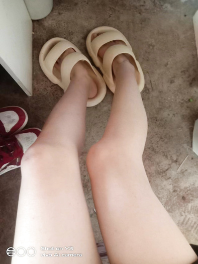 snow white legs