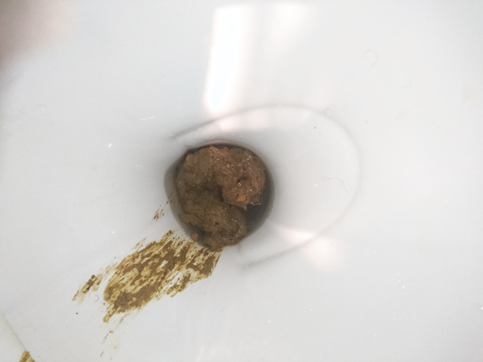 A big poop