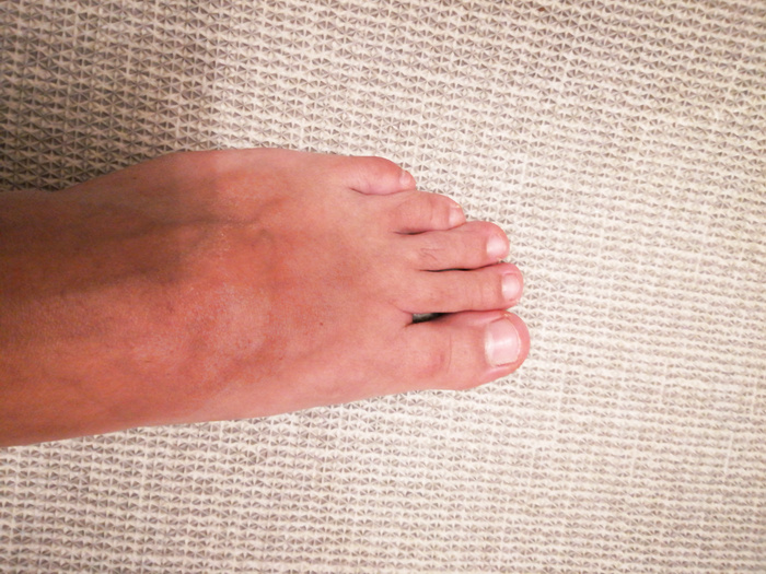 My feet - album 103