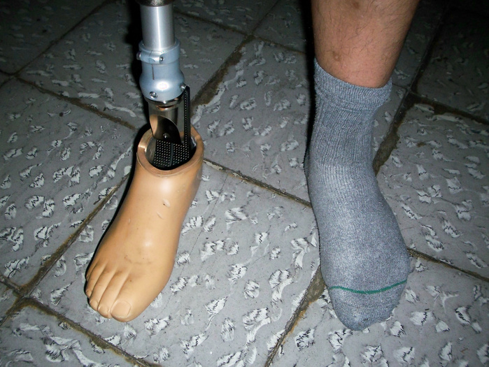 Protesis