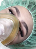 anesthesia masks
