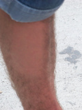 hairy legs