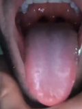 Tongue showing , mouth and uvula