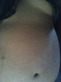 Stupid bloated stomach