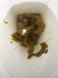 smelly poop