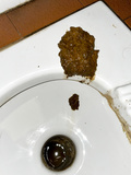 diarrhea in public toilet… oops I missed the hole