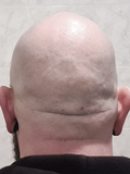 Back of a bald head