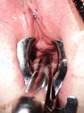 Cervix and urethra sounding