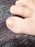 Natural toenails