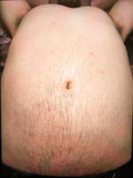 My hairy beer belly