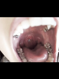 inside my mouth