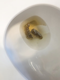 constipated poop