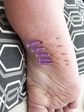 Needles in male foot