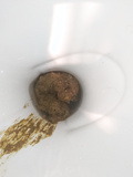 A big poop