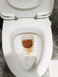 diarrhea at home