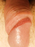 My cock and foreskin.