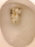 Clogged hotel toilet
