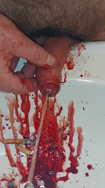 Pissing after burning and needling my cock