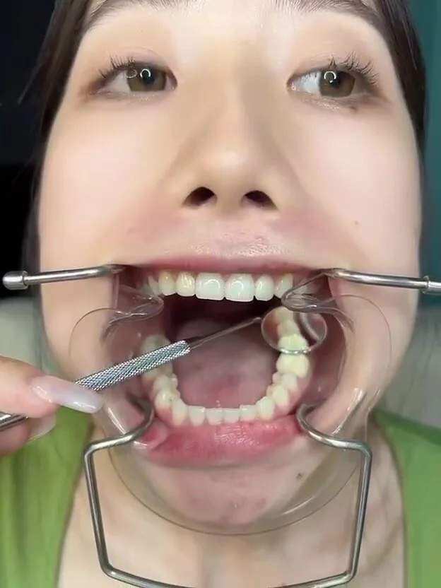 Dental Fetish Porn - Teeth, dentist: fetish-teeth chinese - ThisVid.com