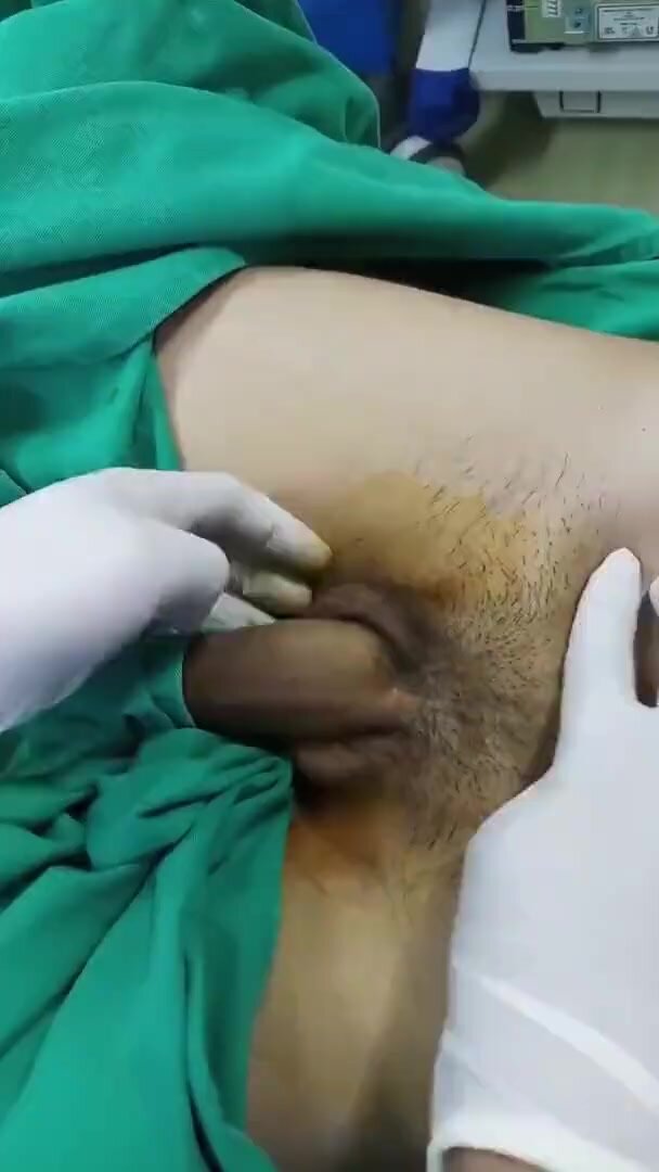 doctor exam penis before surgery circumcision