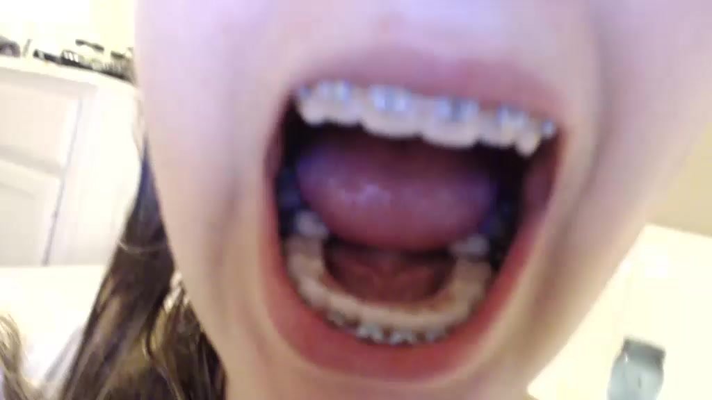 Sexy Camgirl Showing The Inside Of Her Mouth