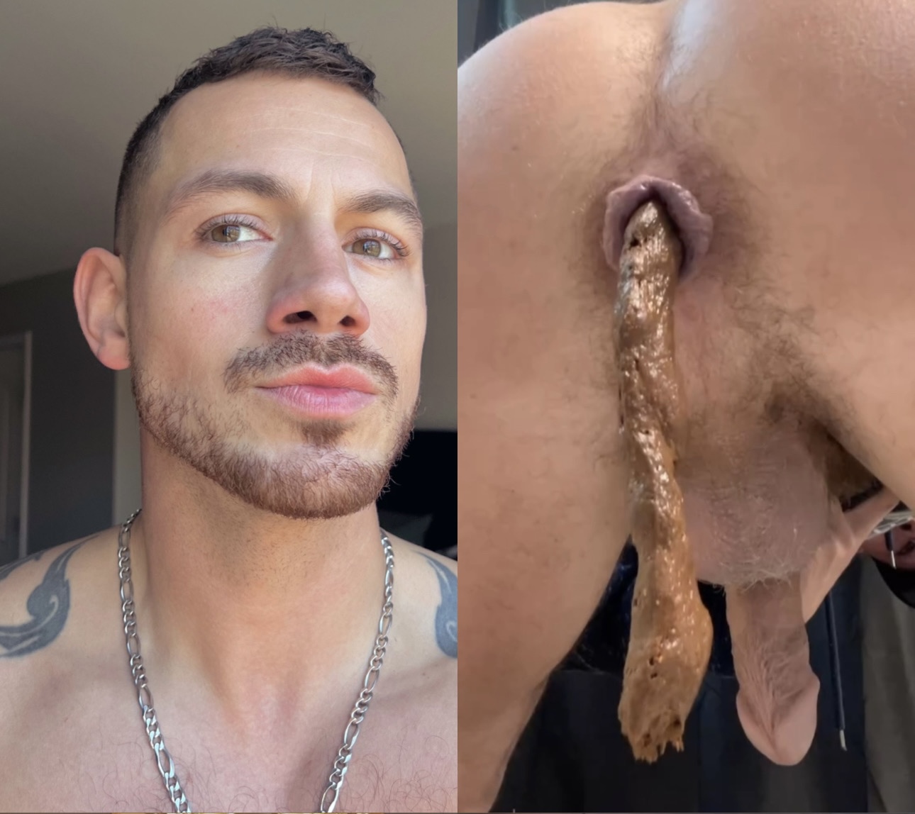 His anal lips *FLARE* as he poops