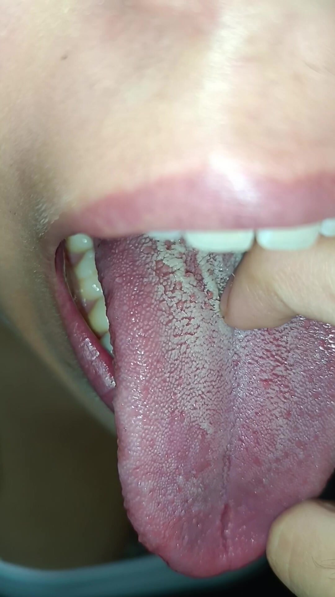 Long white tongue scraping