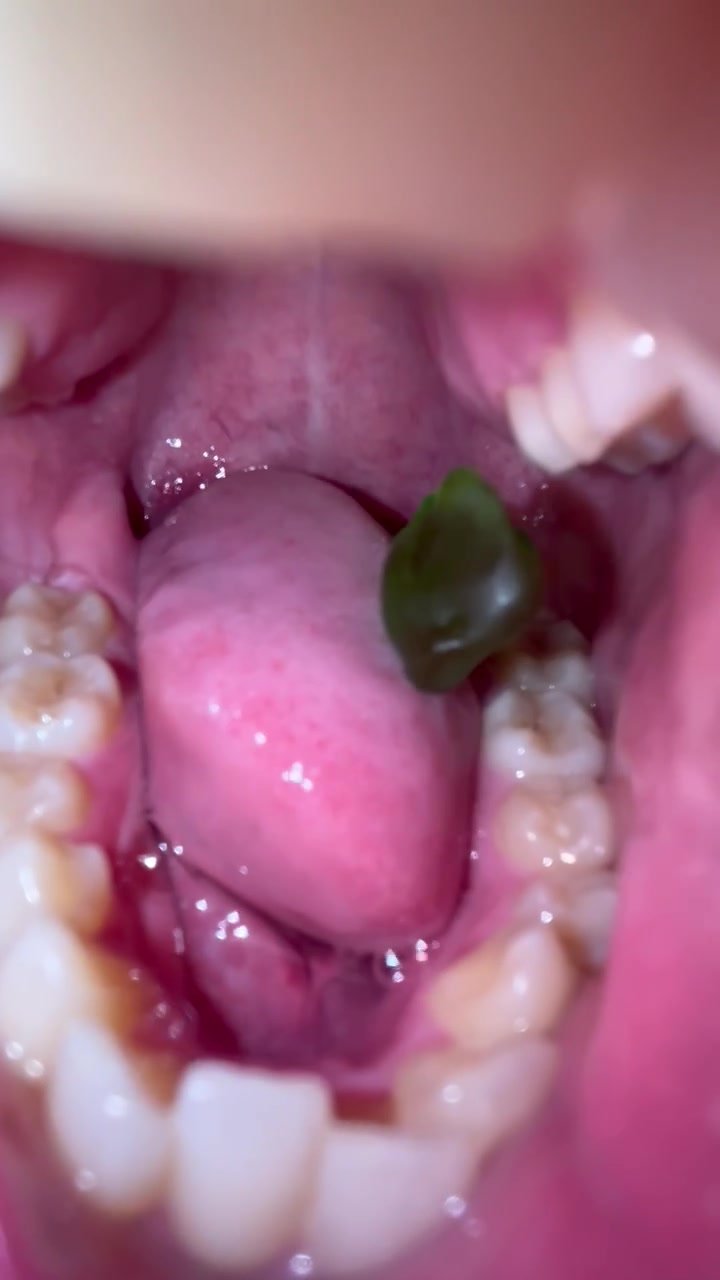 Gummy swallow - video 11