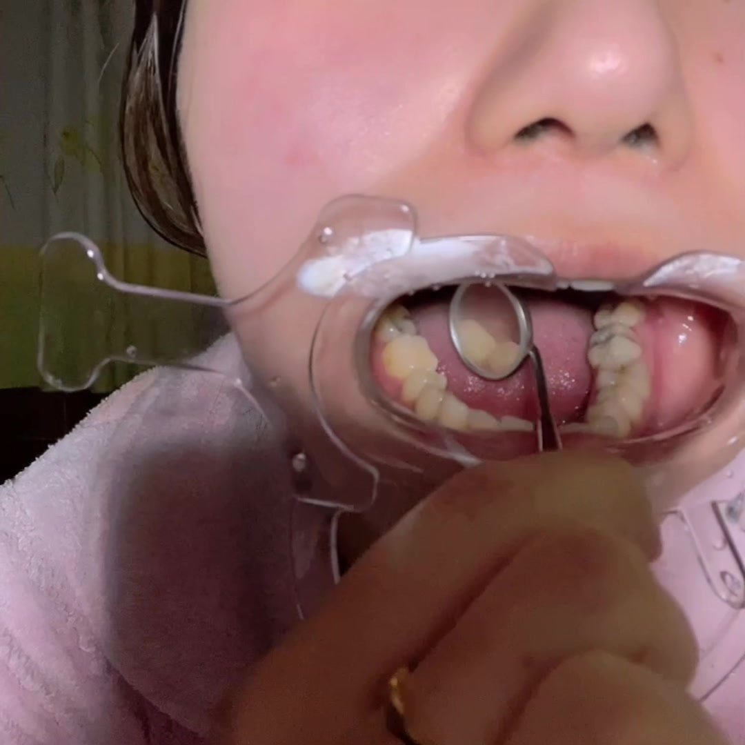 Asian Girl's mouth tooth show 1
