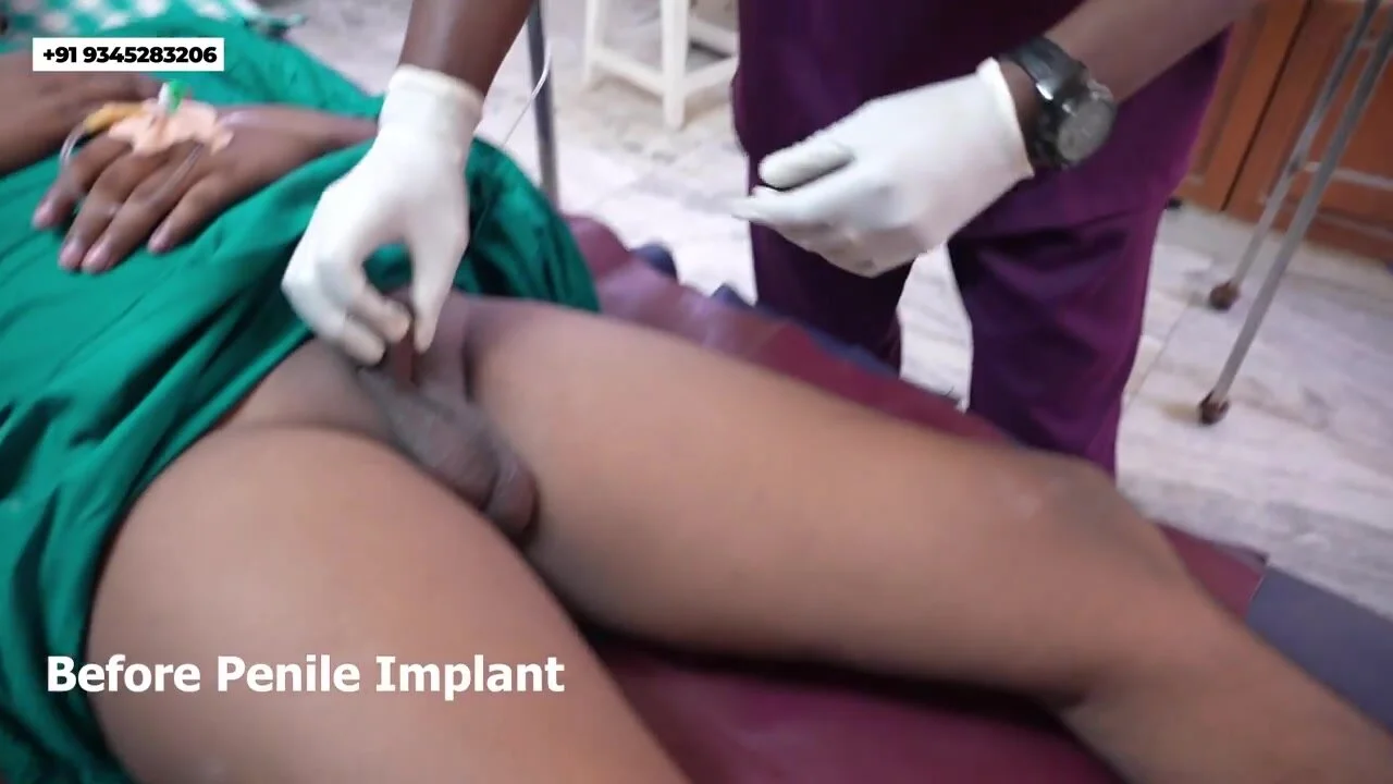 Fetishes: Penile implant - post surgery - ThisVid.com