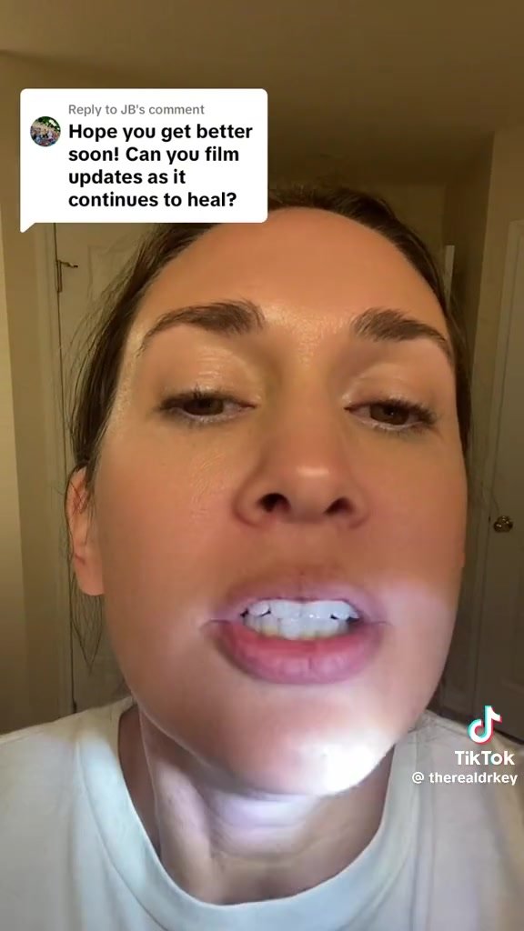 Female doctor shows her uvula and tonsils update